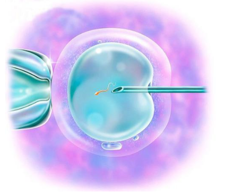 试管婴儿胎移植后能有性生活吗 胎移植后性生活能提高种植率吗2018