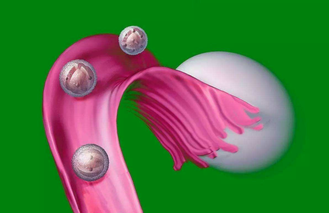 精油按摩可以治疗多囊卵巢吗 多囊卵巢综合征有没有根本治疗方法