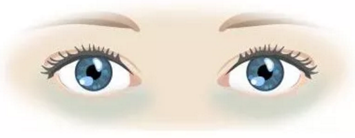 眼睛黑眼圈重可以抹眼霜吗 黑眼圈重怎么保养眼部2018