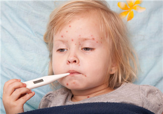 怎么分辨宝宝是不是出疹性疾病 宝宝出疹肌肤如何护理