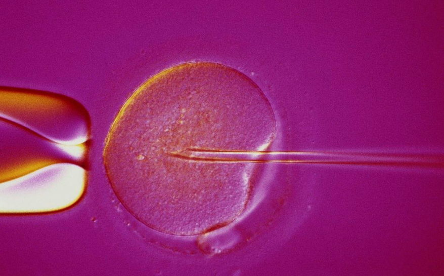 人工受精对医院的要求高吗 怎么选择人工生殖的治疗方式
