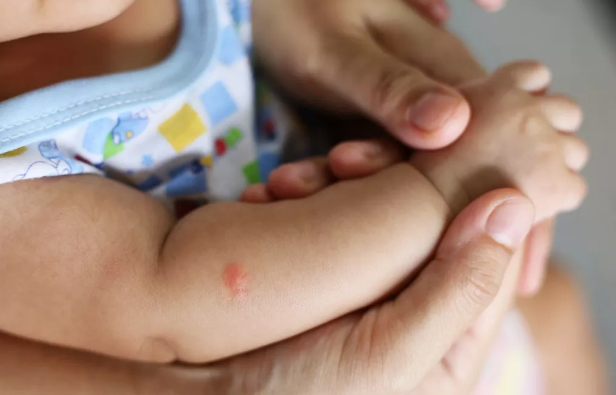 绿药膏多大的宝宝能用 林可霉素和利多卡因凝胶宝宝会过敏吗