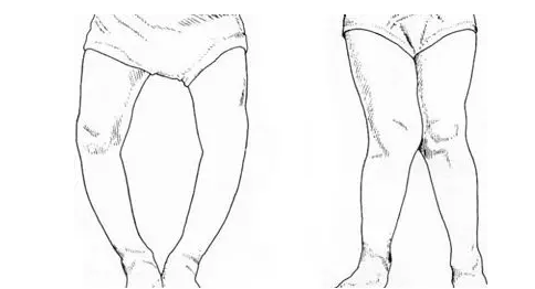 怀孕中后期晚上腿抽筋怎么办 怎么缓解腿抽筋的症状