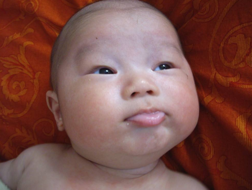 母乳性黄疸可以给宝宝喂奶吗 宝宝黄疸怎么吃奶好2018
