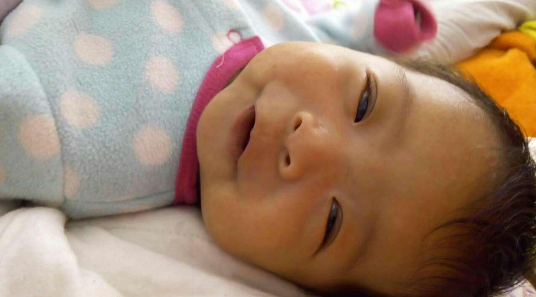 宝宝黄疸在家怎么护理 孩子黄疸怎么做可以缓解2018