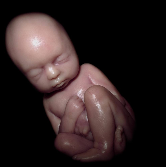 胎儿宫内缺氧会有哪些表现 胎儿宫内缺氧怎么做比较好