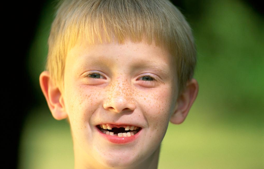 天天刷牙牙齿还是变黄了是什么原因 孩子牙齿什么时候刷比较好