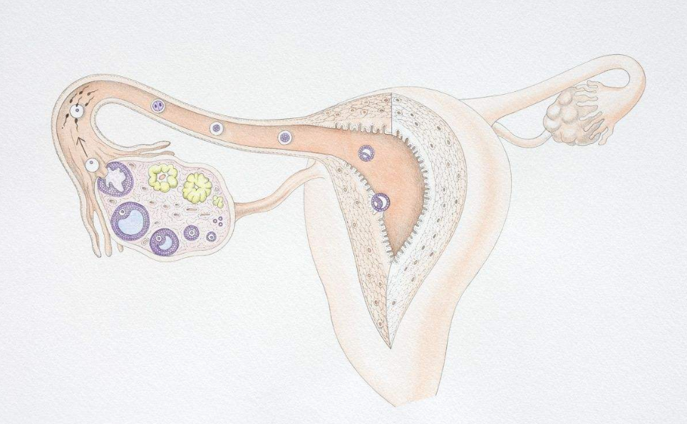 多囊卵巢对试管婴儿有什么影响 多囊卵巢能做试管婴儿吗
