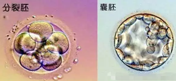 试管婴儿鲜胚移植卵巢体积增大怎么办 鲜胚移植和冻胚移植有什么区别