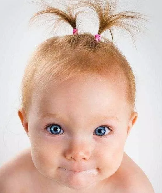 宝宝头发又细又黄怎么办 宝宝头发又稀又黄是缺锌缺钙缺铁吗