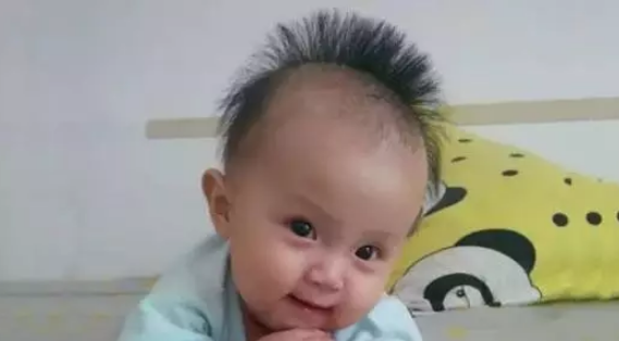 宝宝头发又细又黄是遗传原因吗 宝宝头发又细又黄吃什么好