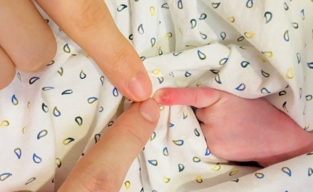 如何正确晒新生儿 新生儿手指硬掰有哪些影响