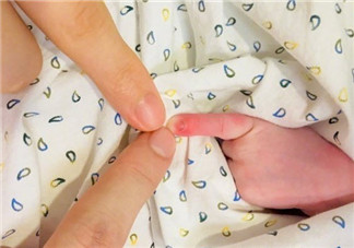 如何正确晒新生儿 新生儿手指硬掰有哪些影响