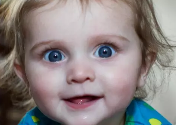 孩子瞳孔发白是先天性白内障 湖北一婴儿瞳孔发白经常哭闹患上老年病