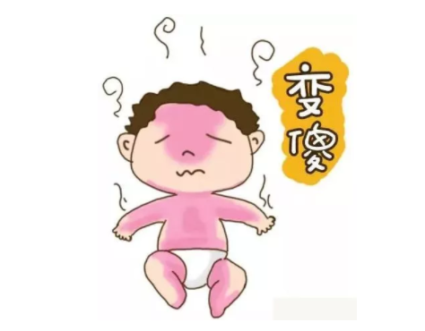 宝宝发烧真的会烧坏脑子吗 为什么孩子那么容易发烧