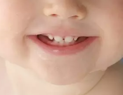 孩子牙齿被磕掉了怎么办 孩子牙齿被磕掉了如何挽救