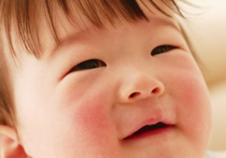 宝宝皮肤皲裂怎么办    冬季宝宝皮肤护理方法