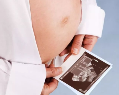怀孕期间为什么要做B超   孕妇做B超的注意事项