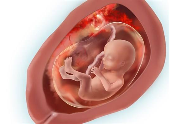什么是胎盘植入 胎盘植入应该怎么治疗