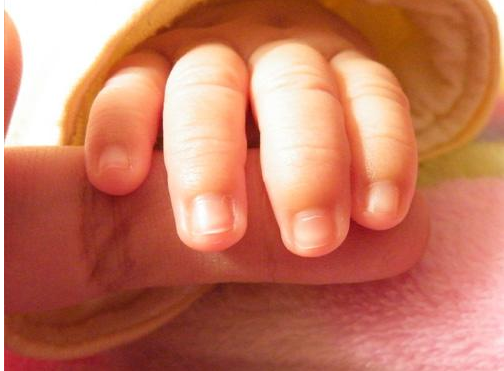 婴幼儿指甲不长是什么原因 如何纠正宝宝咬指甲的坏习惯