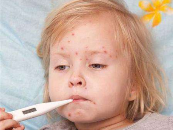 宝宝出了水痘还需要打水痘疫苗吗 宝宝水痘疫苗什么时候打
