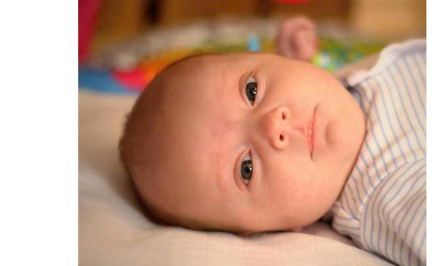 哪些宝宝容易得湿疹 如何预防宝宝长湿疹