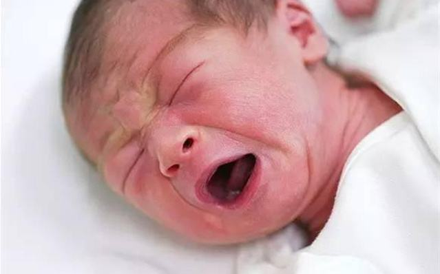 为什么刚出生的宝宝特别丑 孩子的相貌是遗传谁的