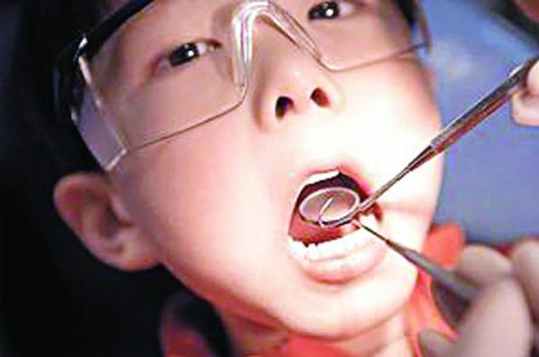 孩子牙齿上的黑线是什么 孩子牙齿上的黑线怎么处理