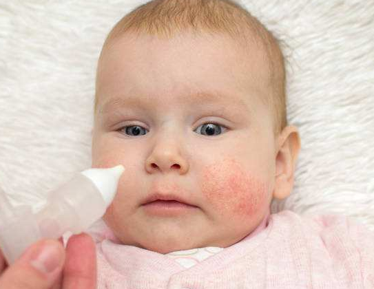 如何预防宝宝过敏 预防宝宝过敏的措施