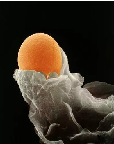 试管婴儿取卵会导致卵巢早衰吗 试管婴儿取卵后怎么保养卵巢