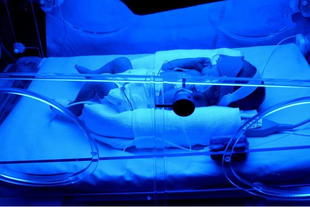 新生儿黄疸照蓝光有什么副作用 新生儿黄疸注意事项