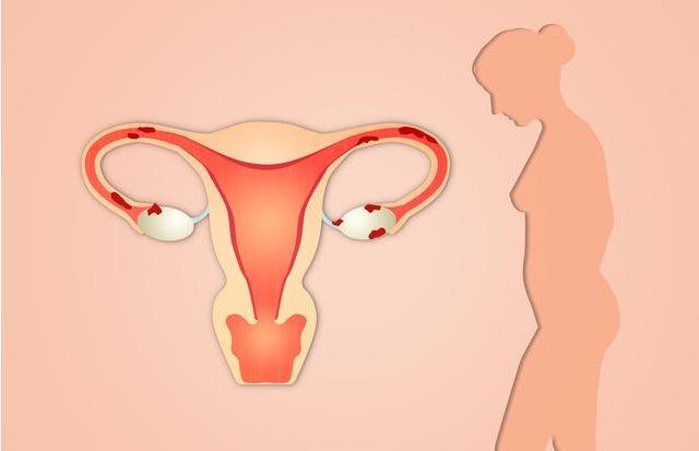 女性子宫下垂有哪些危害 改善女性子宫下垂的方法