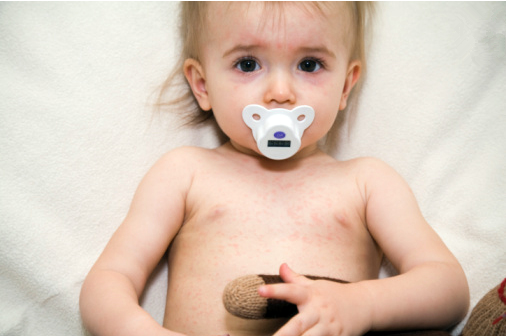 6个月后宝宝为什么容易发烧 6个月宝宝发烧家庭护理妙招