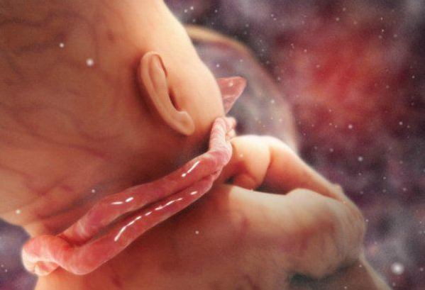 脐带绕颈会造成宝宝缺氧吗 孕期各阶段脐带绕颈的发生几率