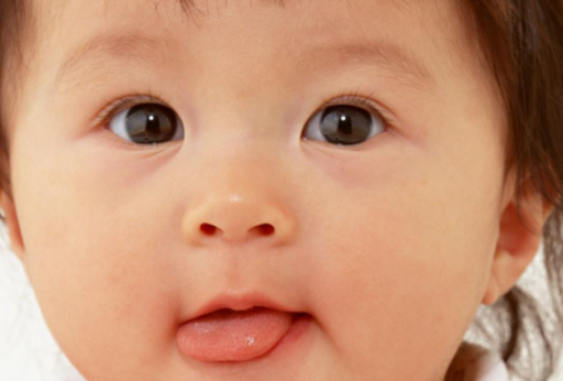 宝宝地图舌是怎么回事 宝宝地图舌的原因
