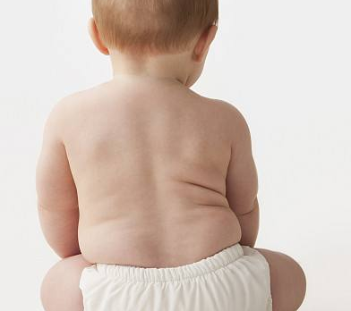 婴儿奶胖怎么回事 婴儿奶胖的原因
