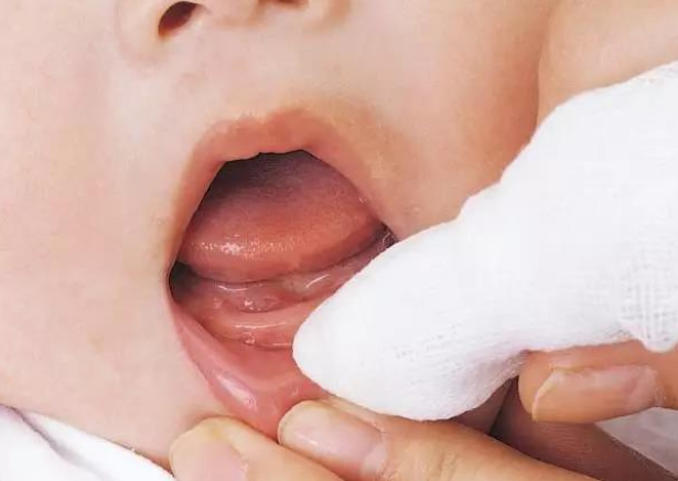 宝宝出牙晚是谁决定的 宝宝出牙护理小技巧