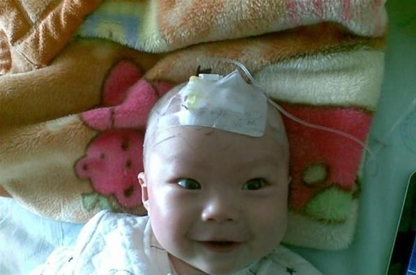为什么宝宝输液扎针在头部 宝宝输液在头部扎针对大脑有影响吗