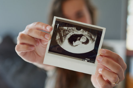 如何通过孕囊大小判断怀孕多久 孕早期B超适合那种情况