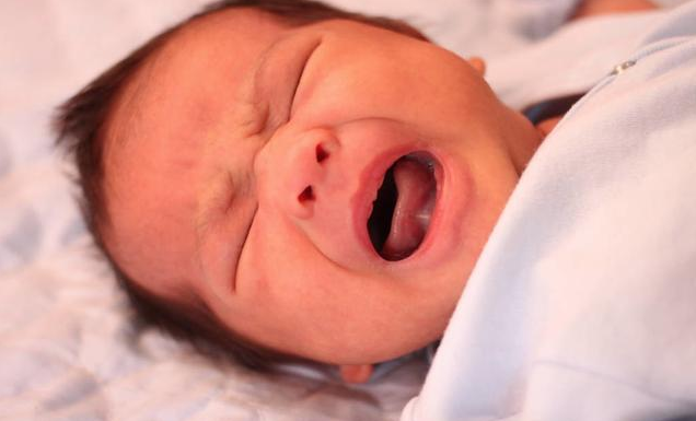 新生儿黄疸值多少才正常 新生儿黄疸的治疗措施