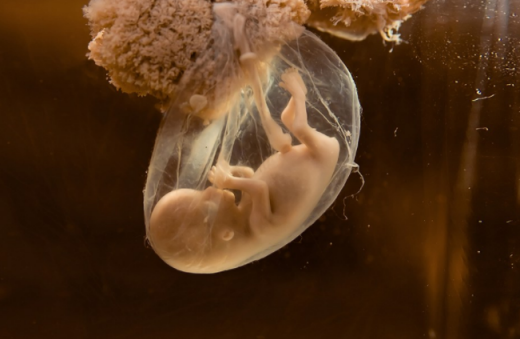 胎儿是喝尿长大的吗 胎儿在肚子里喝尿是真的吗