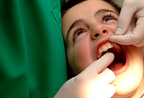 预防宝宝牙齿长歪的方法 换牙期怎么矫正牙齿