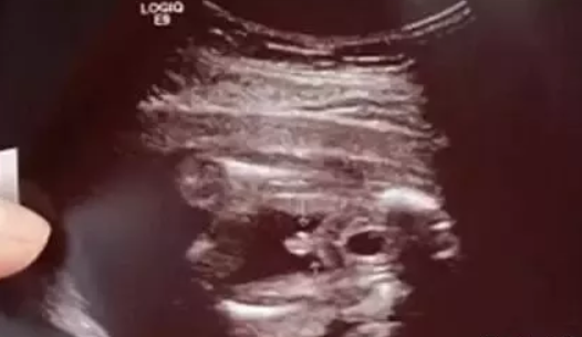 2019年3月13日受孕生男生女怎么看 农历二月初七怀孕是男孩还是女孩
