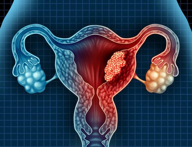 女性感染HPV后身体会有哪些变化 哪些女性容易感染HPV