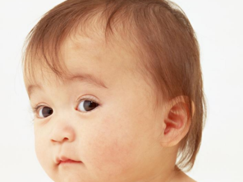 宝宝斜视几岁治疗最好 孩子斜视治疗的时间