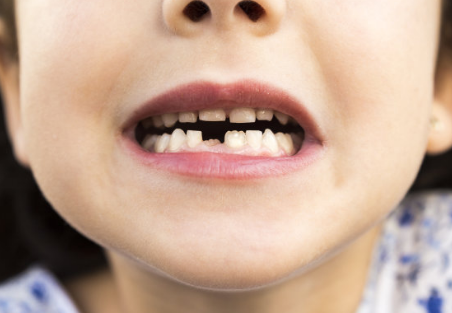 孩子的乳牙要怎么保存 正确保存孩子乳牙的方法