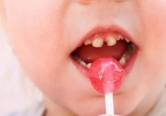 宝宝龋齿是因为吃糖吗 影响龋齿的因素介绍