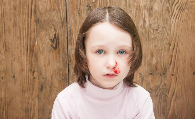 孩子经常流鼻血的常见原因 孩子流鼻血的安全处理方法