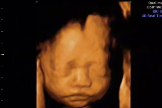 胎儿|胎儿头大是什么原因 胎儿头大的原因
