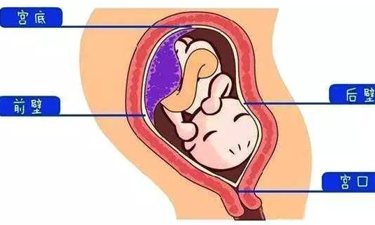 怀孕胎盘前壁后壁有什么区别 前壁和后壁哪个更有利于分娩